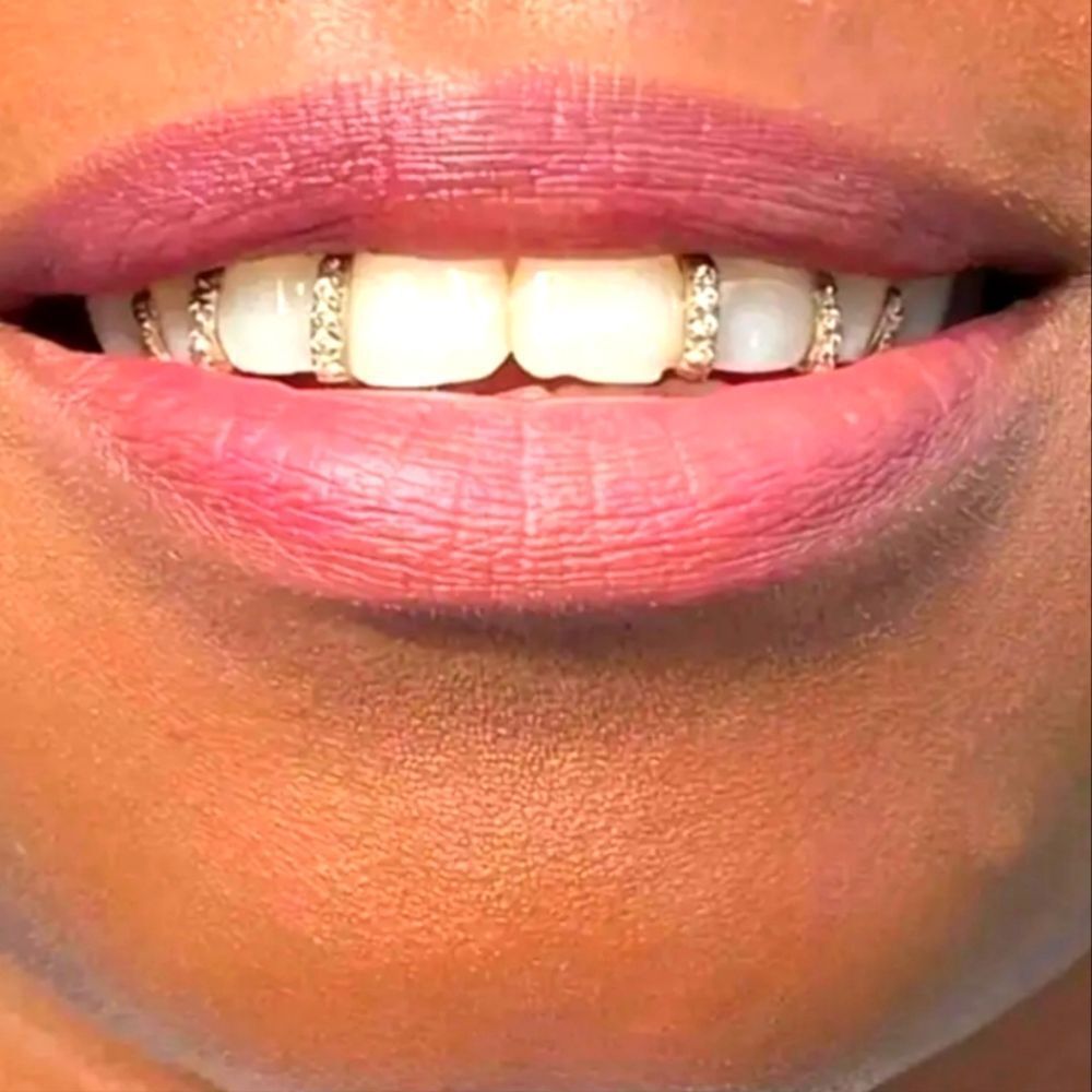 Unisex 5pc Silvery Diamond Grille Set